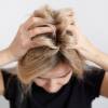 Schuppen unter Kontrolle: Praktische Tipps zur Erhaltung gesunder Haare